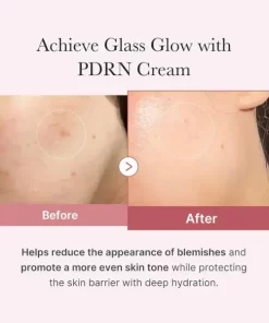 Medicube PDRN Pink Hyaluronic Moisturizing Cream