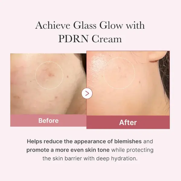 Medicube PDRN Pink Hyaluronic Moisturizing Cream
