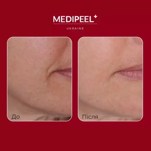 MEDI PEEL Retinol Collagen Lifting Ampoule