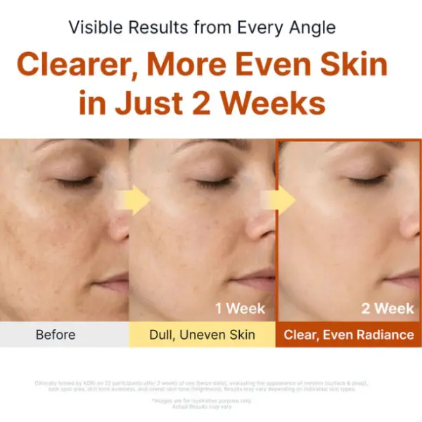 SUNGBOON EDITOR Kojic Acid Niacinamide Brightening Ampoule 40ml - Image 3